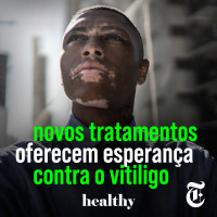 T4E10: Novos tratamentos oferecem esperança contra o vitiligo