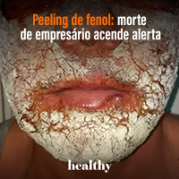 T12E11 - Peeling de fenol: morte de empresário acende alerta
