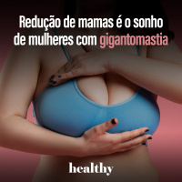 T11E20: Redução de mamas é o sonho de mulheres com gigantomastia